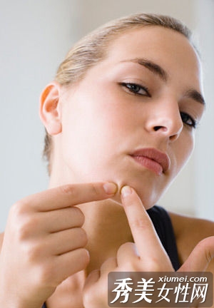 經期問題4:起痘痘